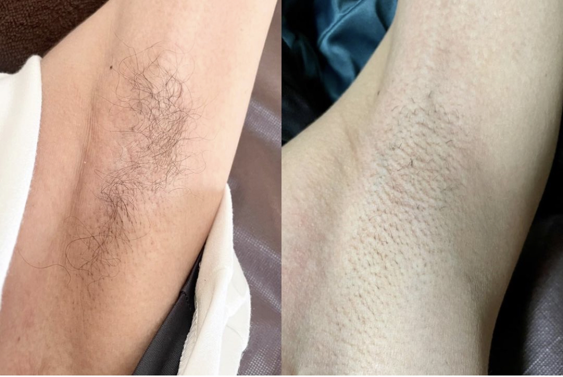 大阪 西淀川区 歌島 塚本 美容室 都度払い脱毛サロン