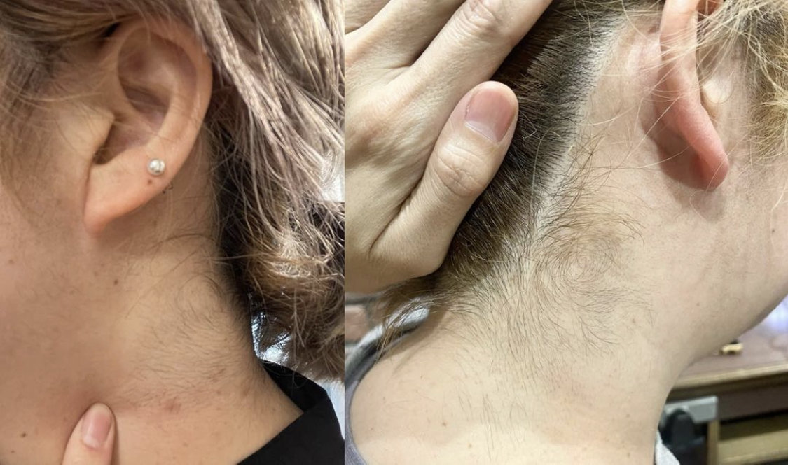 大阪 西淀川区 歌島 塚本 美容室 都度払い脱毛サロン☆西淀川区☆