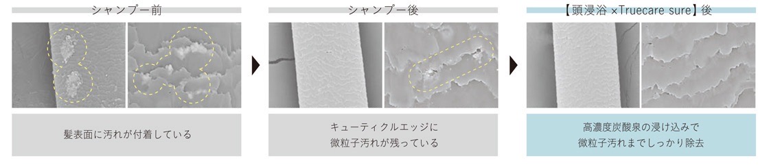 頭皮をやさしく洗浄